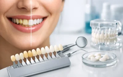 Cosmetic Dentistry for Stained Teeth Options