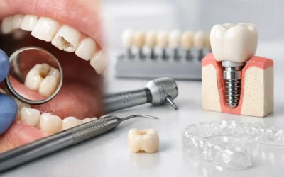 Broken Tooth Treatment Options Explained