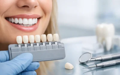 A Patient’s Complete Guide to Dental Veneers